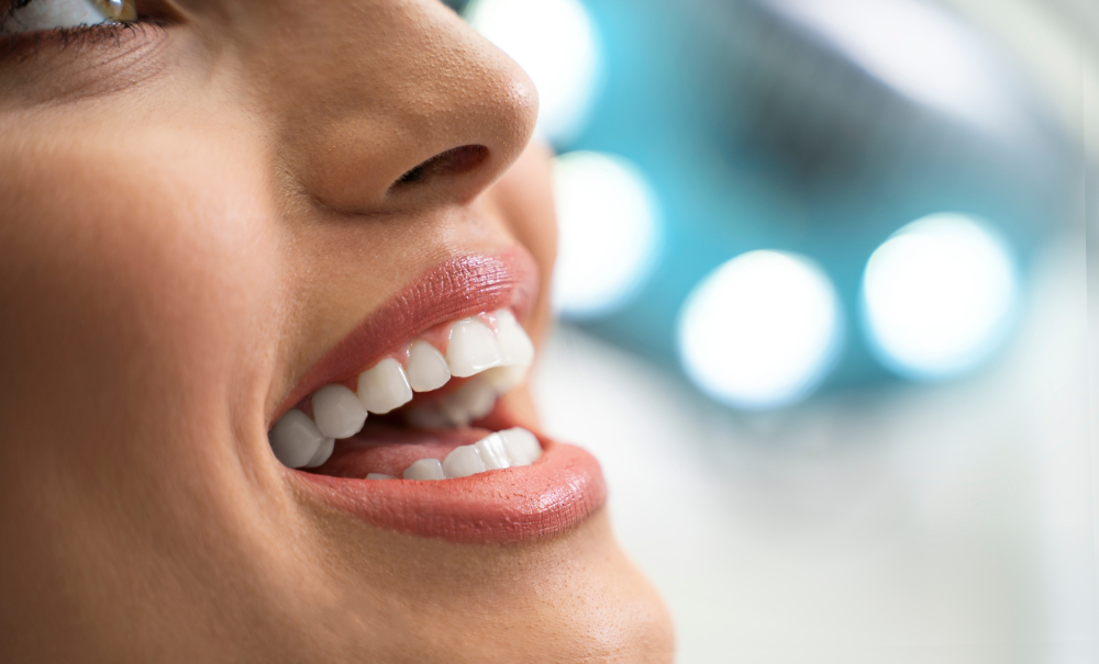 How Long Does Teeth Whitening Last?